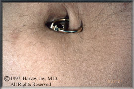 Closeup of the female patient - After