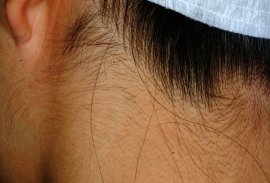 Back of neck of female - After